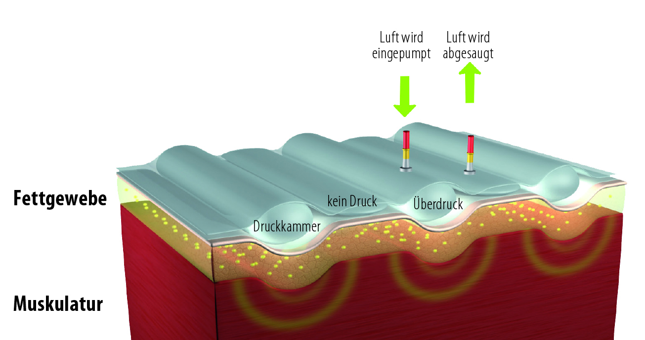 Airpressure Bodyforming